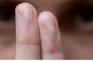 EMDR Therapy Explained